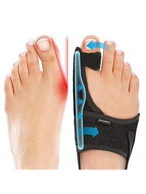 New 2-Pack Bunion Corrector for Women & Men, Orthopedic Bunion Splint